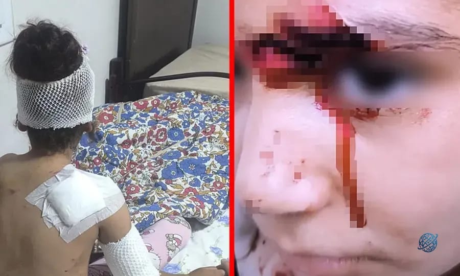 Şanlıurfa'da başıboş köpek dehşeti! 8 yaşındaki çocuğa saldırdılar: 150 dikiş atıldı!