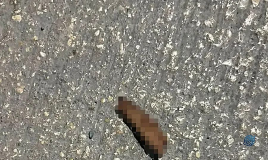Fabrikaya atmaya çalıştığı patlayıcı elinde patladı: Parmağı koptu!