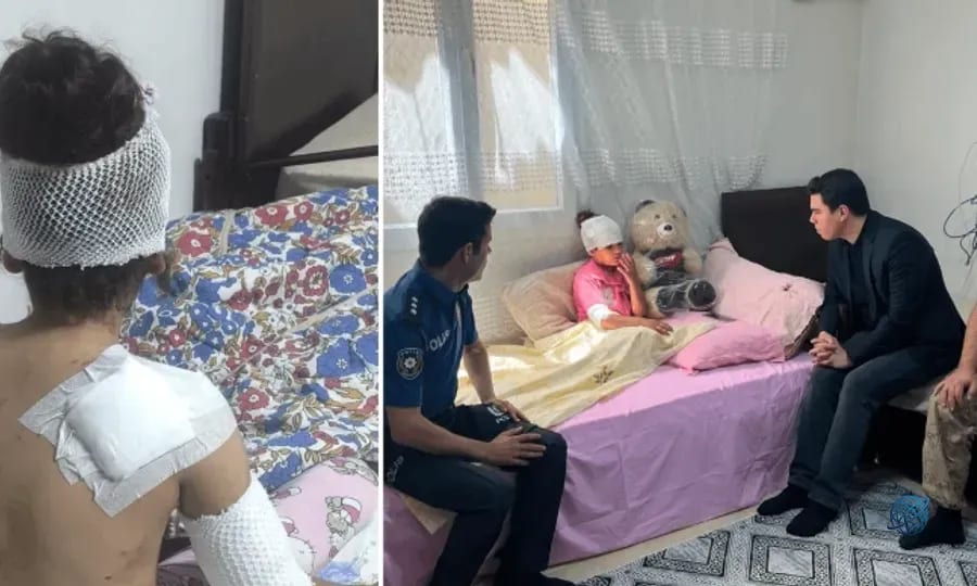 Suruç’ta başıboş köpekler 8 yaşındaki çocuğa saldırdı: 150 dikiş atıldı