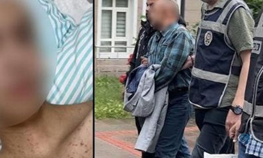 Komadan çıktı, her şeyi anlattı! Tacize direndiği iddiasıyla başından vurulan çocuk felç kaldı