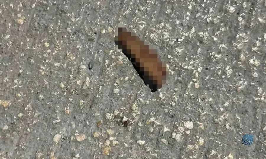 Fabrikaya atmak istediği patlayıcı elinde patladı: Parmağı koptu
