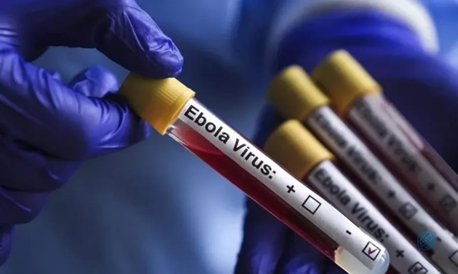 Ebola’ya karşı yeni umut: İlk deneysel aşı insanda denendi
